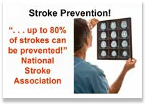 Stroke Prevention