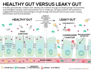 Leaky Gut