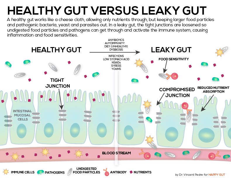 What Does It Mean To Have A Leaky Gut Dan Hammer Health LTD what-does-it-mean-to-have-a-leaky-gut-dan-hammer-health-ltd