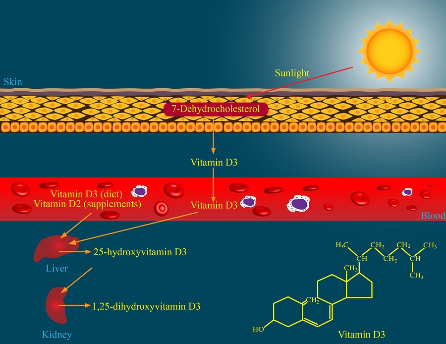 CoVid19 and Vitamin D Deficiency